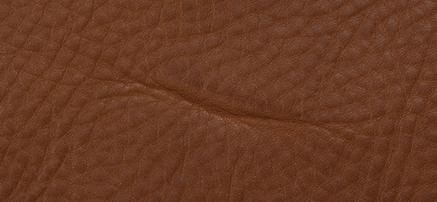 Fat Wrinkles - Healed_Scars.jpg 